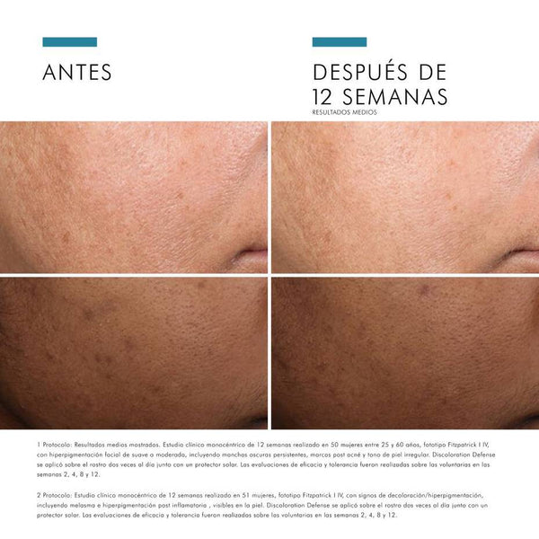 SKINCEUTICALS PROTOCOLO COMPLETO ANTIMANCHAS