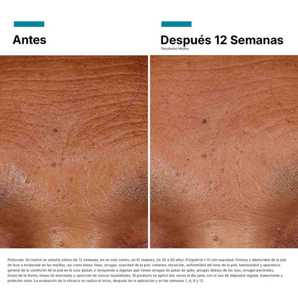 SKINCEUTICALS PROTOCOLO COMPLETO ANTIMANCHAS